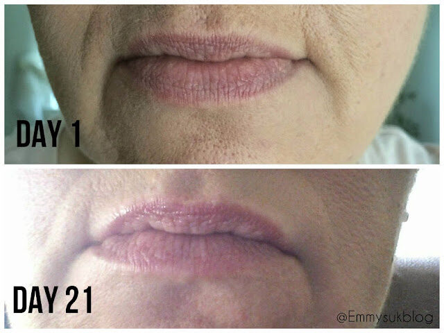 Wrinkled Lips